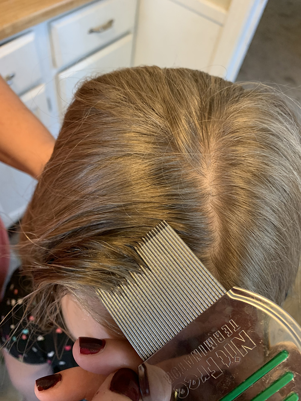 Overland Park, Kansas Head lice treatment & Mobile (inhome) removal